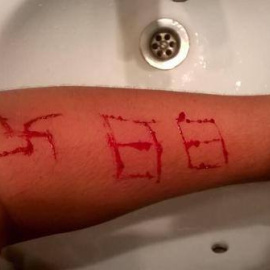 Imagen del brazo del menor tras la agresión por parte de miembros un grupo de extrema derecha.