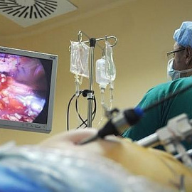 El diagnóstico precoz del cáncer de colon permite curarse al 90% de los pacientes,- EUROPA PRESS