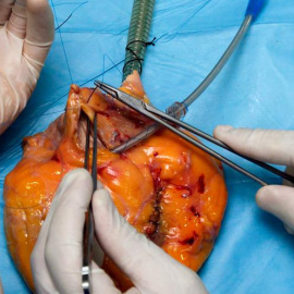 Detalle de las investigaciones en un laboratorio para la producción con células madre de órganos bioartificiales para trasplante, en Madrid. EFE/J.J. Guillén
