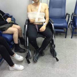 A.J. tras la primera agresión