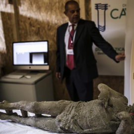 Una momia de Pompeya es examinada mediante una tommografía axial computarizada, en un proyecto  que investiga los hábitos, el empleo y las clases sociales de las víctimas de la erupción del Vesubio en el año 79 d.C. EFE/Cesare Abbate