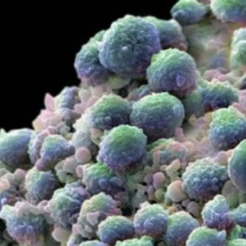 Imagen de células cancerosas. / EFE