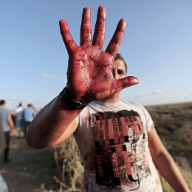 Un palestino muestra su mano manchada de sangre en la frontera este de Gaza. EFE
