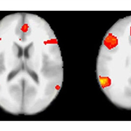 Áreas activas en las mentiras en secciones escaneadas de un cerebro.-UNIVERSIDAD DE PENSILVANIA