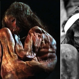 Momia del Aconcagua. En el recuadro superior se muestra una imagen de una parte del pulmón diseccionado que se ha utilizado para la extracción de ADN. SINC/Universidad Nacional de Cuyo (Argentina).