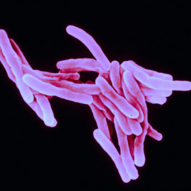 La tuberculosis está causada por la bacteria Mycobacterium tuberculosis, que destruye el tejido pulmonar. / Sanofi Pasteur