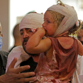 Un padre y su hija, heridois por la explosión del Puerto de Beirut, tras ser atendidos en un hospital. AFP/IBRAHIM AMRO