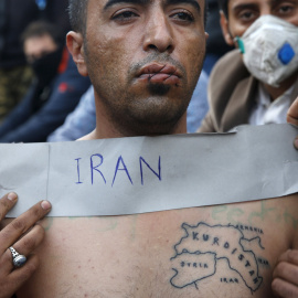 Un inmigrante iraní con los labios cosidos se sienta en las vías del tren en la frontera entre Grecia y Macedonia. REUTERS/Yannis Behrakis