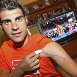 Óscar Pereiro enseña una cicatriz. /EFE