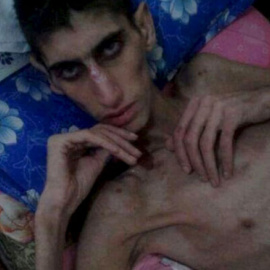 Una fotografía sin fecha tomada en Madaya y distribuida por las redes sociales. REUTERS