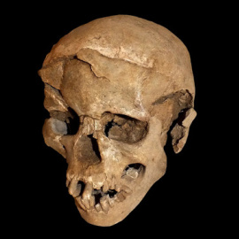 Los esqueletos hallados en Nataruk (Kenia) muestran signos de un posible ataque intergrupal en el pasado. En la imagen, uno de los cráneos encontrados, en el que se aprecian las lesiones en las partes frontal y lateral. / Marta Mirazon Lahr