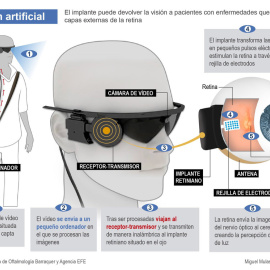 Los tres primeros implantados con un ojo biónico muestran importantes avances en su visión