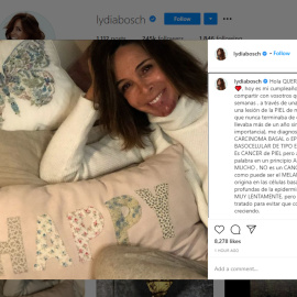 Lydia Bosch confiesa que tiene cáncer de piel