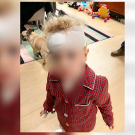 El hijo de Chiara Ferragni tiene un accidente que le deja una brecha