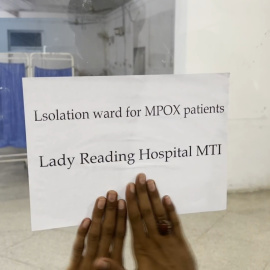 Pakistán confirma el primer caso del brote de mpox en Asia