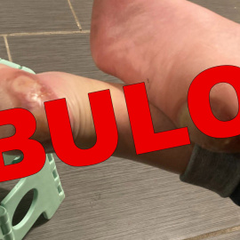 La historia de la foto que originó un bulo antivacunas