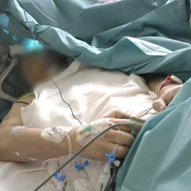 Extirpan un tumor cerebral mientras el paciente juega al ajedrez