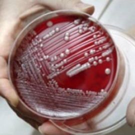 Cepa de "superbacteria" SARM resistente a los antibióticos