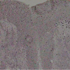 Imagen al microscopio de un corte de médula espinal. En él pueden verse las células que están activadas (en negro en la mitad derecha de la imagen). / Cortesía de Jose Vicente Torre