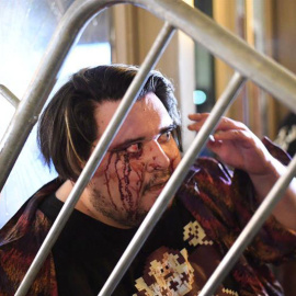 Un estudiante herido durante las violentas manifestaciones. | NOAH BERGER (EFE)