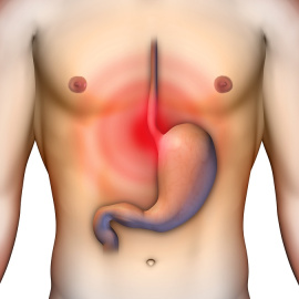 Evitar y controlar la acidez y el reflujo, medida de prevención del cáncer de esófago.