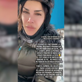 Carla Barber comparte imágenes de su operación tras fracturarse la tibia