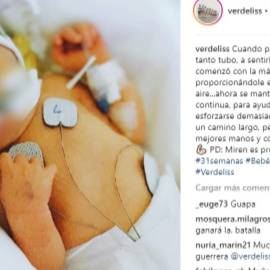 Verdeliss vuelve a subir una foto de su hija Miren