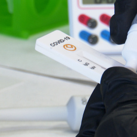 Crean un test rápido de anticuerpos con una sensibilidad del 98%