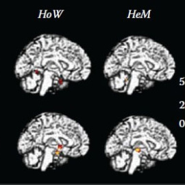 Actividad cerebral al oler AND y EST en heterosexuales femeninas, homosexuales femeninas, heterosexuales masculinas y homosexuales masculinos (de izquierda a derecha).- KAROLINSKA INSTITUTE