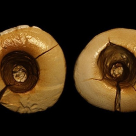 Imagen de los dos empastes dentales encontrados. AMERICAN JOURNAL OF PHYSICAL ANTHROPOLOGY (2017)