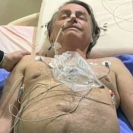 Bolsonaro, hospitalizado por fuertes dolores abdominales