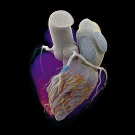 Imagen del corazón con el nuevo escáner que cuenta fotones.