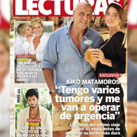 Kiko Matamoros tendrá que operarse de urgencia