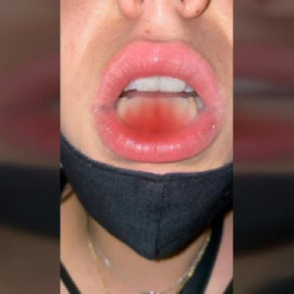 Sube un video mientras su expareja la agrede y la policía consigue localizarla y detener al presunto autor de la paliza