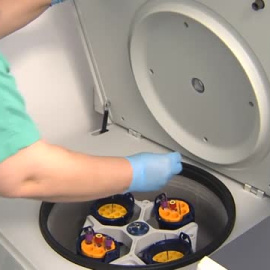 Asociaciones de pacientes triplican las ayudas de emergencia a personas  con cáncer y en riesgo laboral