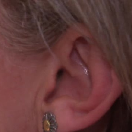 Más de tres millones de personas en España sufren acúfenos