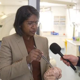 Una neurocirujana extrae un gusano de 8 cm del cerebro de una paciente