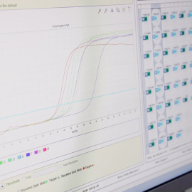 Pantalla de un ordenador con resultados positivos de viruela del mono, en el Hospital Ramón y Cajal, a 30 de mayo de 2022, en Madrid.