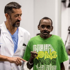 El cirujano Pedro Cavadas (i) y su equipo presentan el resultado de la reconstrucción parcial del rostro y la mano izquierda de un paciente keniano. /EFE