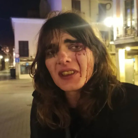 La mujer víctima de la brutal agresión.