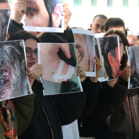 Joves amb imatges de les lesions patides pels protestants en el marc del desallotjament de la Massana