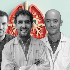 La tuberculosis es una de las enfermedades infecciosas más antiguas de la humanidad