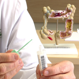 Un doctor de l'Hospital Clínic mostra el tub del test de sang oculta en femta que es fa servir en el cribratge de la detecció precoç del càncer colorectal, amb un model anatòmic del còlon a darrere