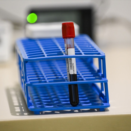 Una muestra de sangre en una clínica de Bruselas, a 23 de febrero de 2021.