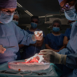 Trasplantament de ronyó a l'Hospital Clínic de Barcelona
