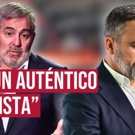 El presidente del Gobierno de Canarias, Fernando Clavijo, ha tildado este jueves de "auténtico fascista" al presidente de Vox, Santiago Abascal, tras pedir que se confisque y se hunda el barco de Open Arms, que ha atracado en Tenerife.

Nuestro periodismo es posible gracias a nuestros suscriptores. Únete a la República de Público y defiende el periodismo valiente, feminista y de izquierdas: https://bit.ly/3REUOTN

Periodismo, investigación y compromiso para construir un mundo más igualitario.
¡Suscríbete ya a nuestro canal!: https://bit.ly/2U8nM0q
Visita: https://www.publico.es
Síguenos en Facebook: https://www.facebook.com/diario.publico/
Síguenos en Twitter: https://twitter.com/publico_es
Síguenos en Instagram: https://www.instagram.com/publico.es
Síguenos en TikTok: https://www.tiktok.com/@publico_es
Síguenos en Bluesky: https://bsky.app/profile/publico.es