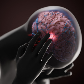 Ilustración conceptual de una migraña.