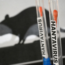Silueta de una rata tras tubos de laboratorio con test de hantavirus.
