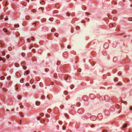 Vista microscópica de células infectadas con hantavirus.