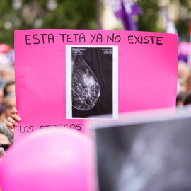 Concentración para exigir mejoras en el cribado del cáncer de mama